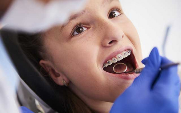 L’ORTHODONTIE: LA SOLUTION POUR ALIGNER LES DENTS